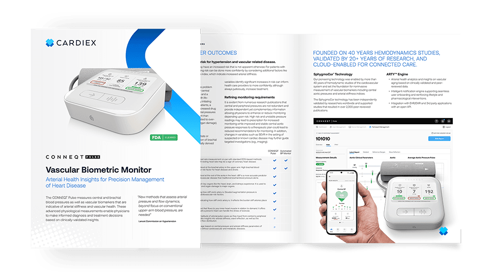 Conneqt Pulse