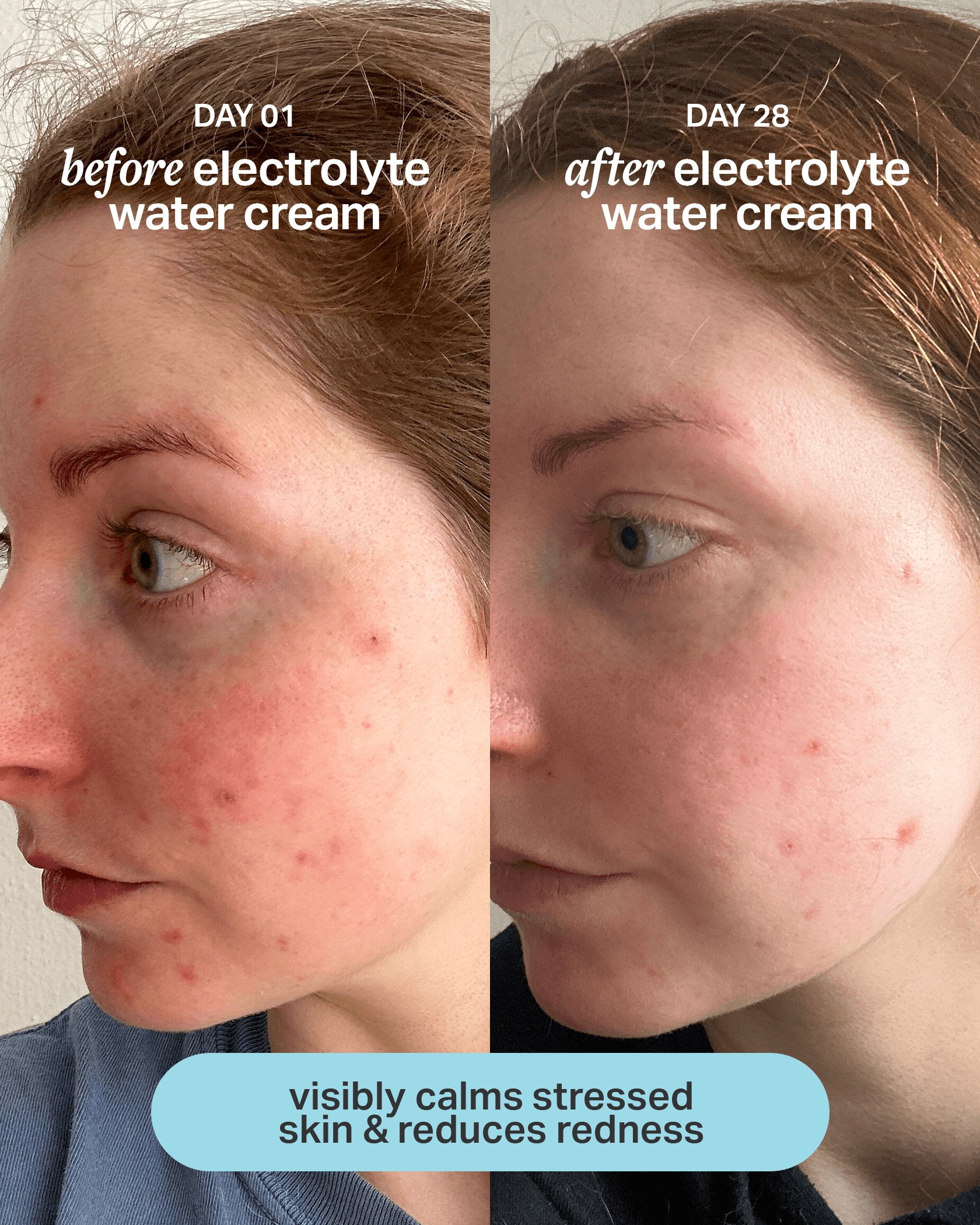 Electrolyte Water Cream - Thumbnail 5